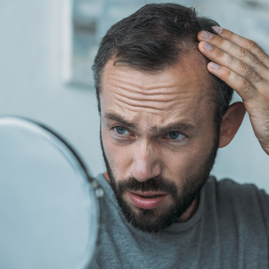 The Ultimate Guide to Men's Hair Replacement Systems: Everything You Need to Know